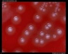 Streptococcus pyogenes